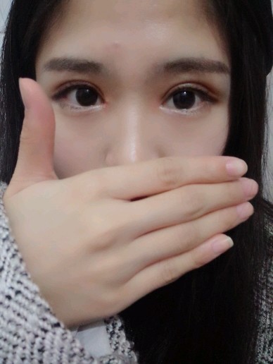 北京同城 | 开内眼角 | 全切开双眼皮 | 眼部整形 | 开眼角 | 双