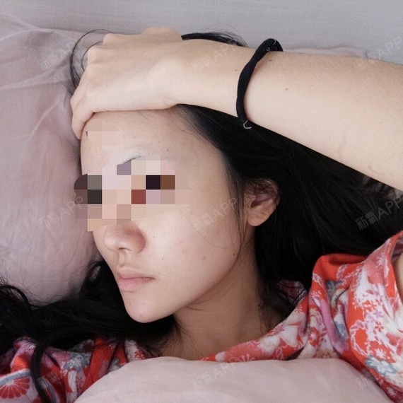 本人有轻微地包天,牙齿矫正过,目前的咬合是正