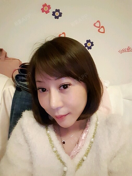 术后27天了哦_时间过得好快哦_手术快一个月了_在_圈子-新氧美容整形