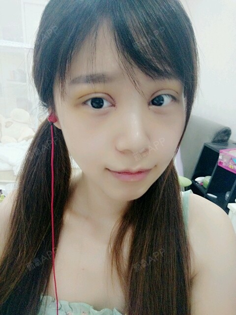 开内眼角好不好_效果图_小冉冉要变美开内眼角术后第4天_新氧美容整形