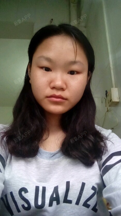 我小眼睛单眼皮,皮肤不紧致,暗黄暗黄的皮肤,脸大,鼻子也大,人