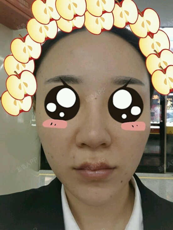 早起来一张,我就是这么懒,不想弄美颜,贴纸遮一遮,看嘴巴就好了