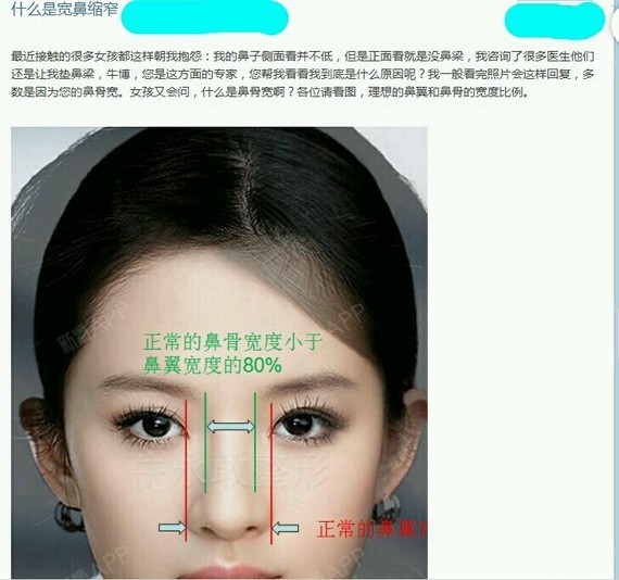 术前鼻孔就是这样滴