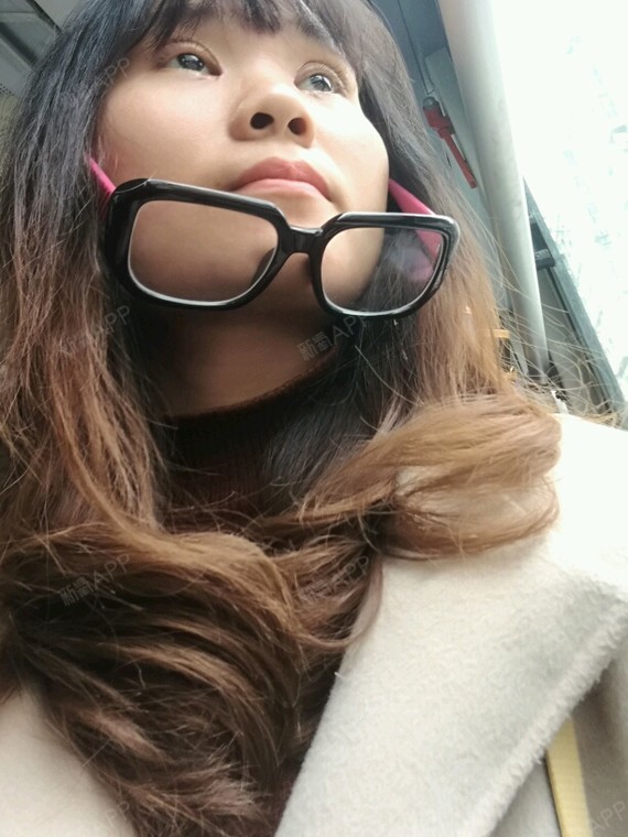 成都开内眼角好不好_效果图_苟拉拉开内眼角术后第5天_新氧美容整形