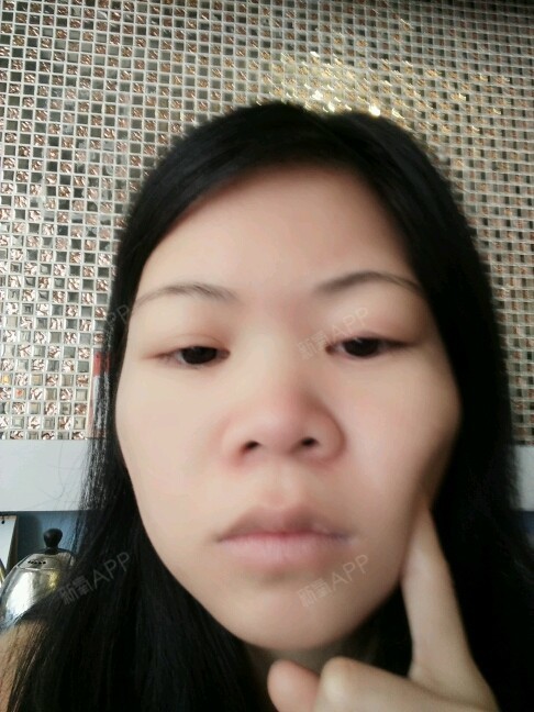 我这是大肥脸 大饼脸吧?