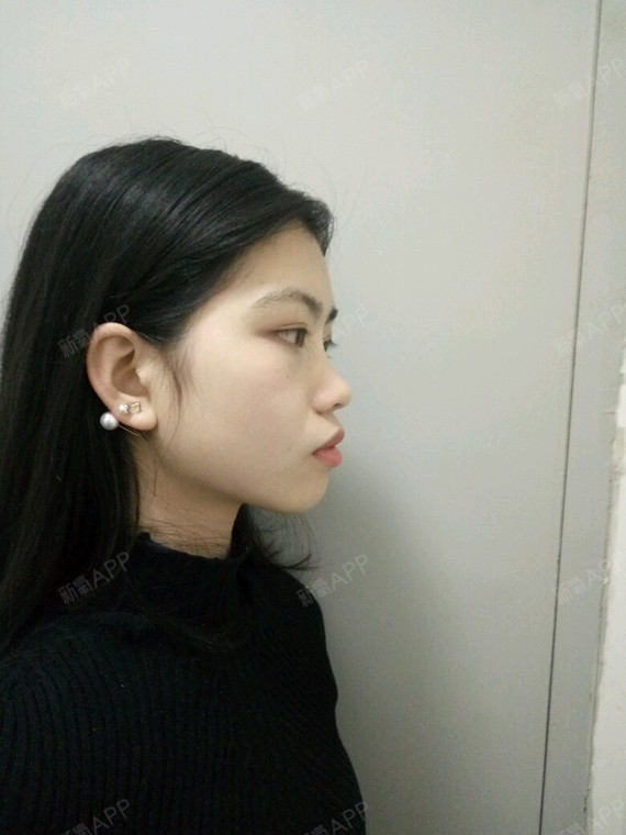 觉得自己突嘴挺严重的.还有鼻子也不好看.