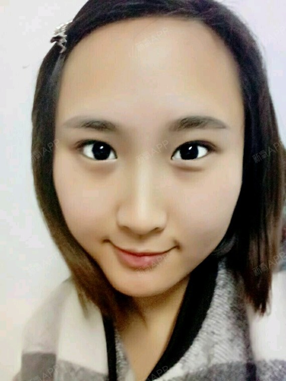 遗传的大脑门,从小被人说大人说聪明有福气,但是却被_圈子-新氧美容