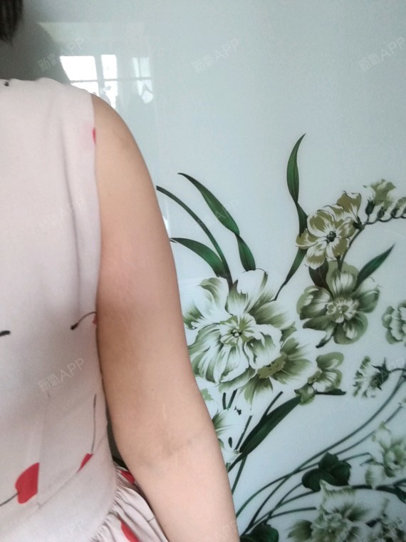 日记时间到了,最近有一个不好的发现,手臂上侧出现了_圈子-新氧美容