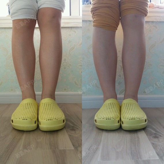 不知道怎么搞的,我感觉肉毒素对我小腿效果不大啊?