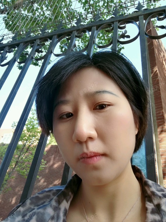 鼻头上的肉还是挺多的,感觉鼻子高了,但肉厚,自己本_圈子-新氧美容