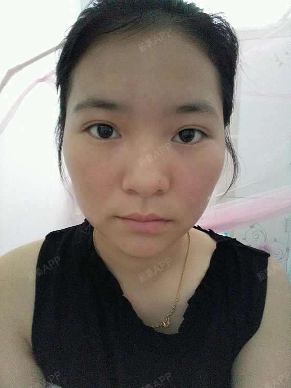 鼻梁不高,五官不立体,额头不饱满,颧骨太高了,关键是皮肤还黑