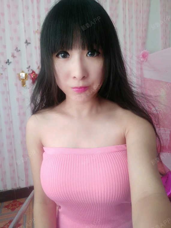 泡沫isara自体脂肪隆胸第15天美丽日记