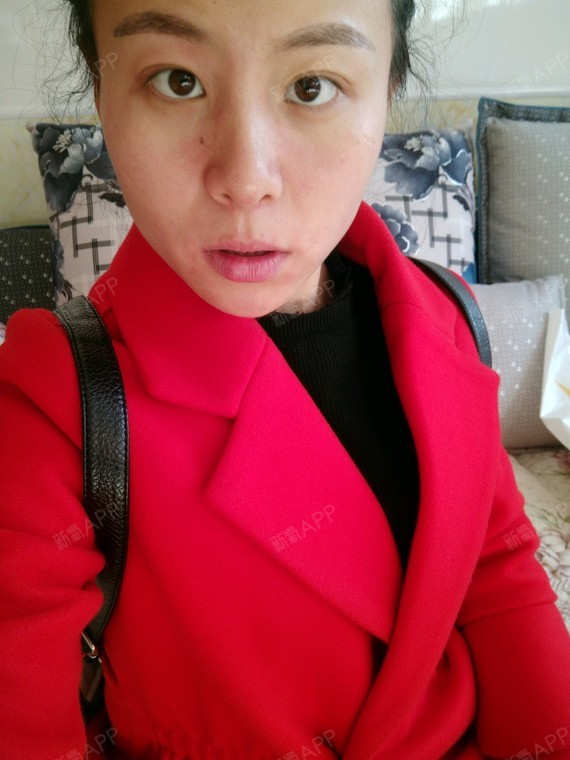 额头上有一点伤疤