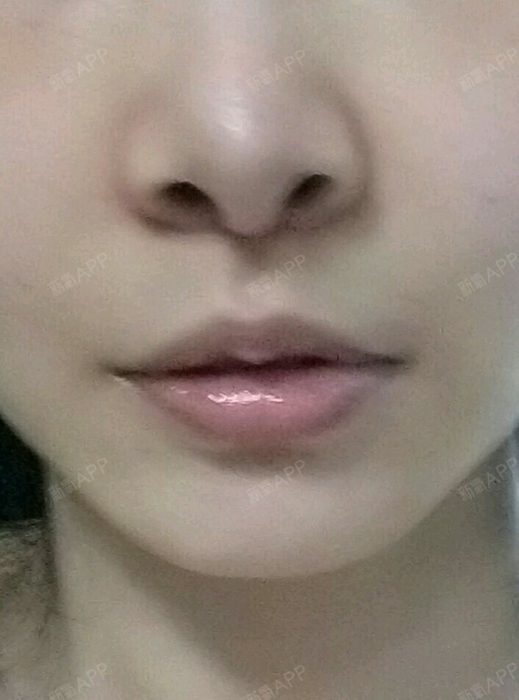 人中缩短两个月出头啦,基本不变了.