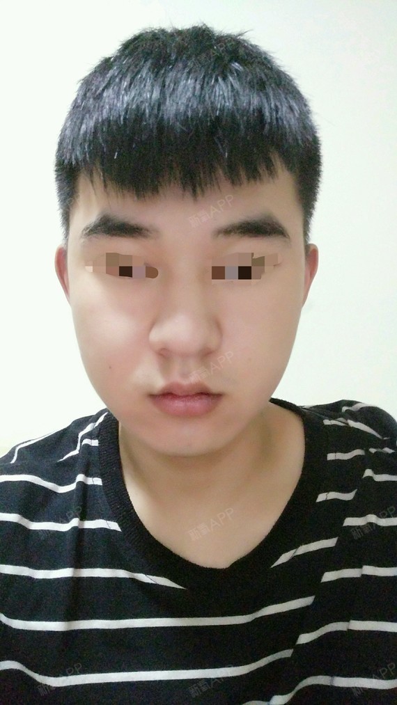 脸肥下巴肥大怎么瘦下来轮廓