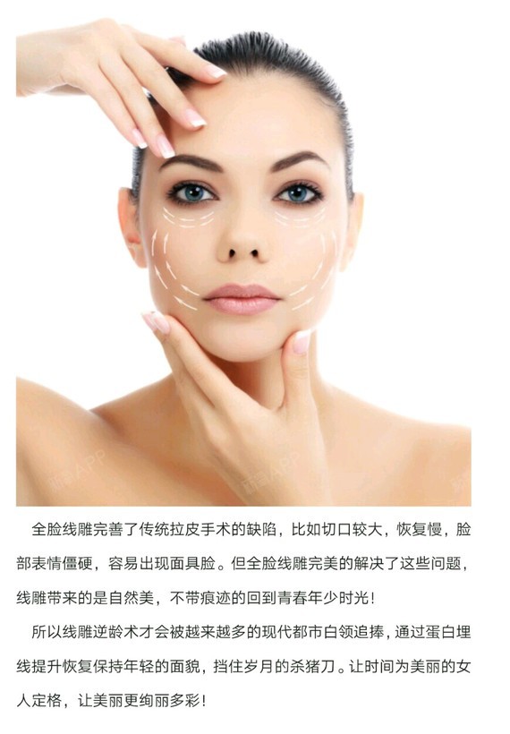线雕--蛋白埋线提升你的逆龄神器,让你永远十八岁!_圈子-新氧美容整形