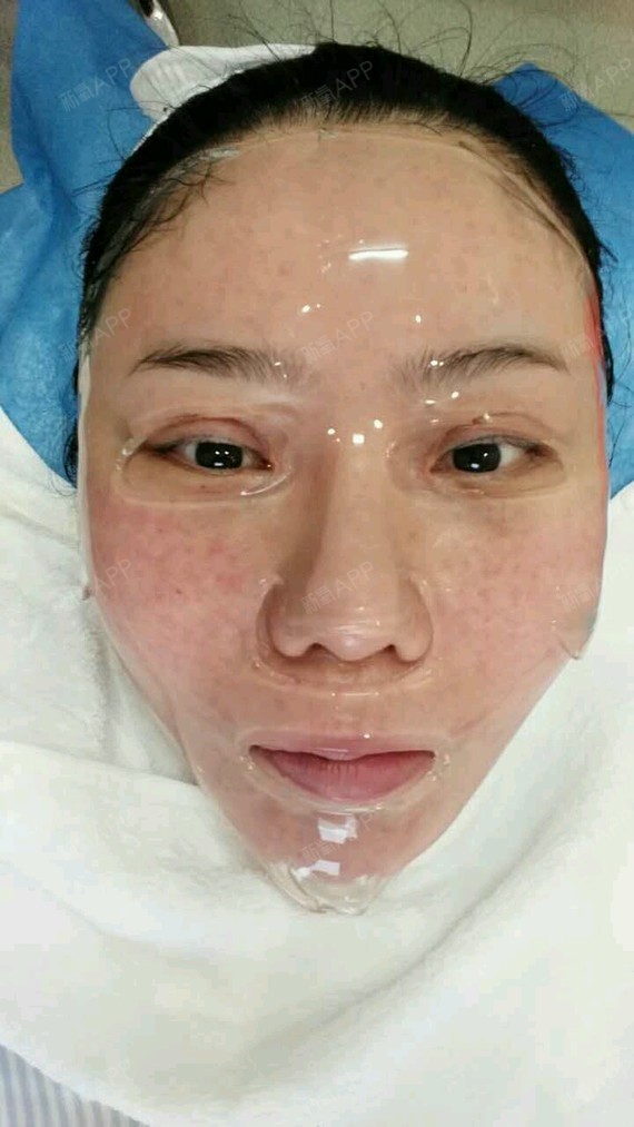 整形美容去红血丝（整形美容去红血丝有用吗） 整形美容去红血丝（整形美容去红血丝有效
吗）《整形医院去红血丝怎么样》 整形美容