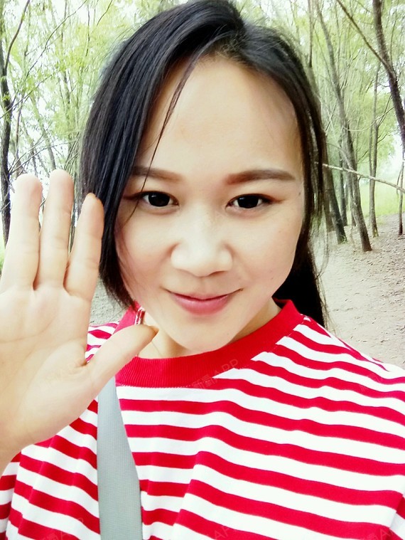 新氧- 山韵 | 眼部 | 开眼角 | 双眼皮 | 开内眼角 | 切开双眼皮 | 术