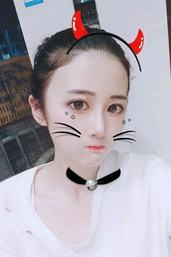 两仪式脱发际线术后第12天美丽日记_新氧整形