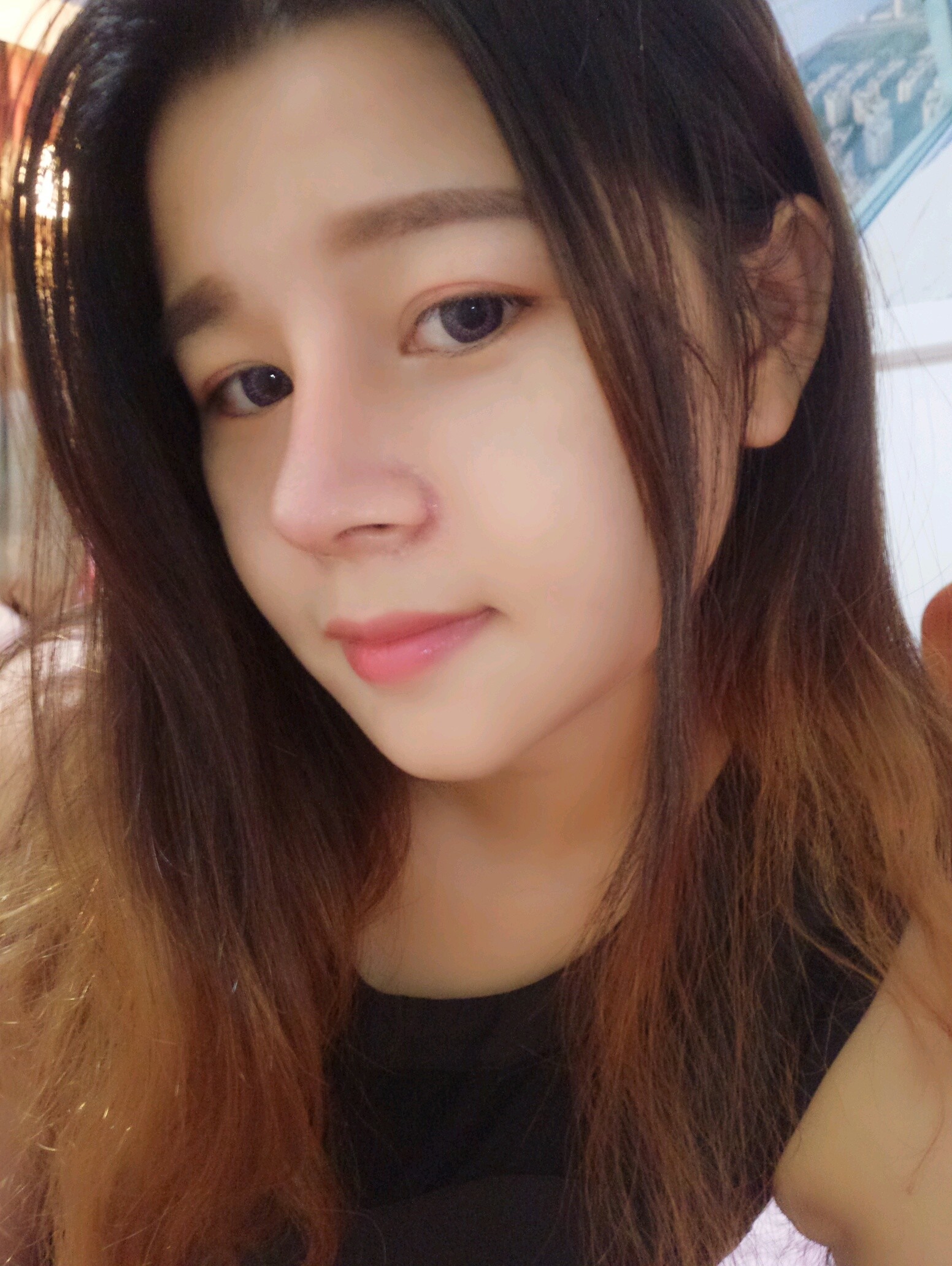 小小妖精精溶脂针瘦脸第74天美丽日记-新氧美容整形