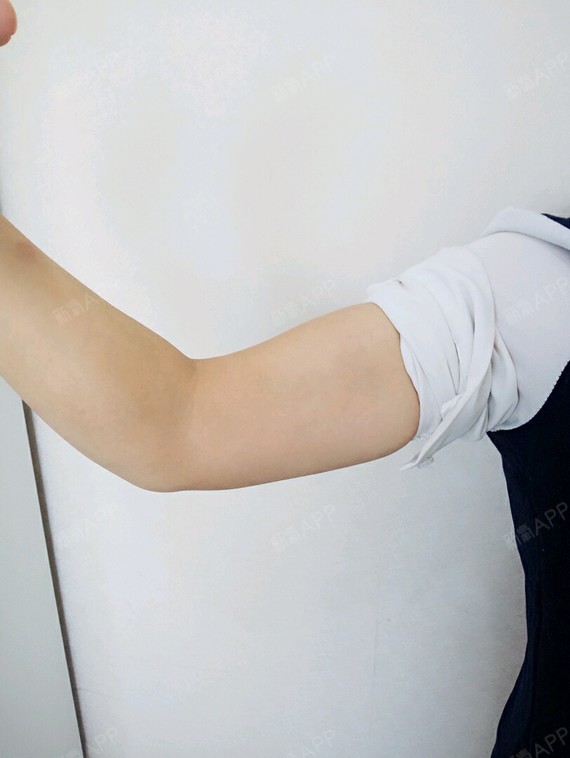 巴啦巴啦小魔仙子冷冻溶脂瘦手臂第0天美丽日记