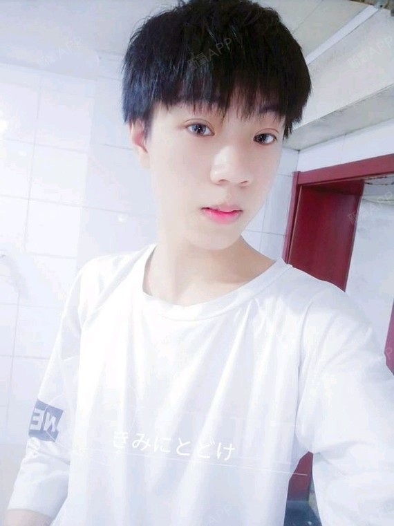 埋线双眼皮好不好_效果图_氧气6no0c6b埋线双眼皮术后第天_新氧美容