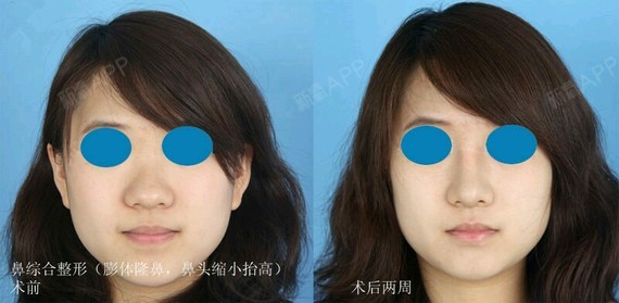 圆头鼻 如梅般枝头俏丽,百媚丛生