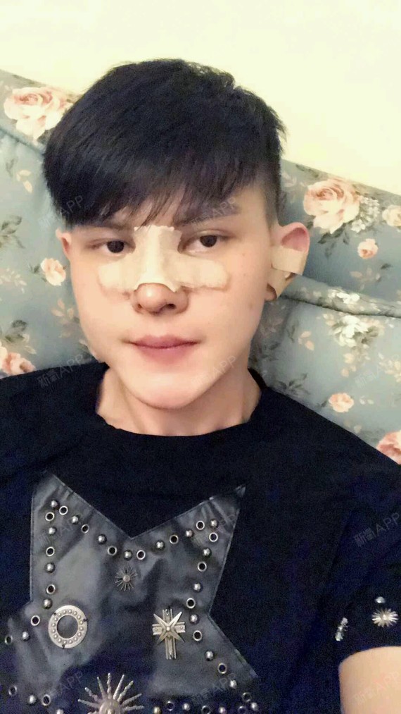 没有疼痛感,自己也在家做了鼻子的清洁消毒,伤口处不_圈子-新氧美容