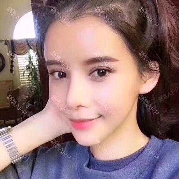 隆鼻的风格有很多,有人追求的是明星风,有的是欧美