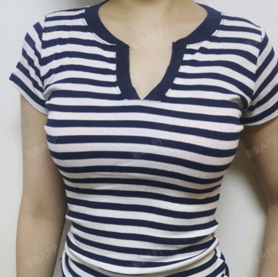 新氧- 牛栏山上花 | 胸部 | 美体塑形 | 隆胸 | 假体隆胸 | 术后当