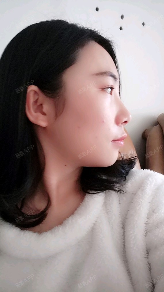 想请问一下嘴巴有点凸带牙套可以纠正牙骨吗