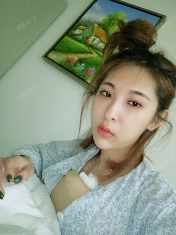 第二天,做的进口曼托,高凸,275.说实话这个绷带_圈子-新氧美容整形
