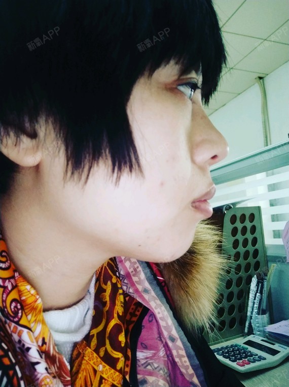 颌面矫正手术是个笼统的说法,具体分为上颌前