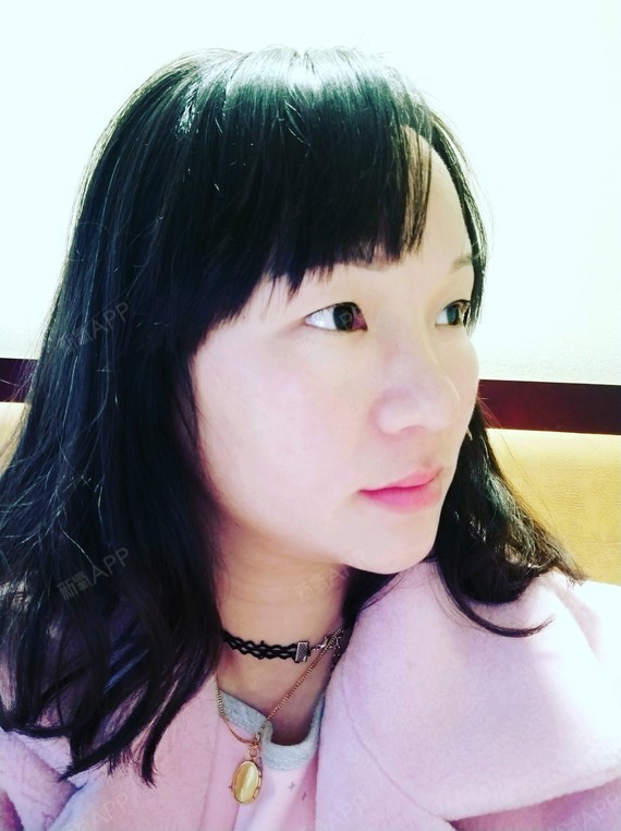 侧面45度角度的样子:鼻头真的很大,鼻小柱很短.