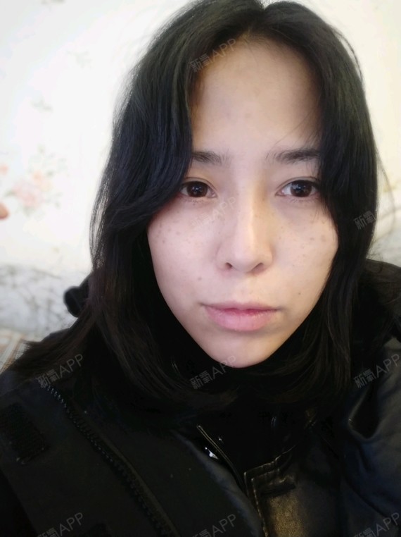 嘴巴有点突,感觉面中部凹陷,怎么改善