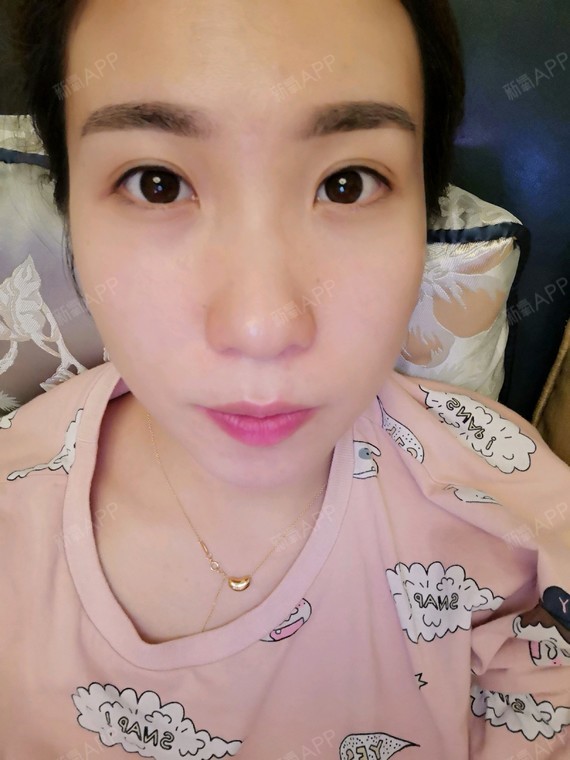 美瞳线到第十六天是真的无感,在第7天就结痂掉完了.