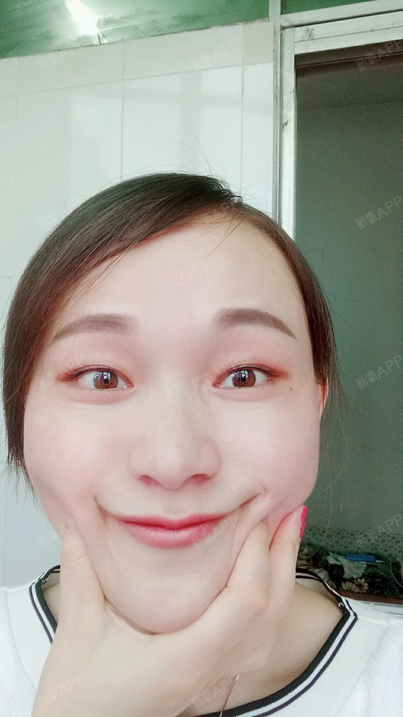 内双的人适合做什么样的双眼皮