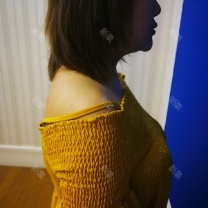 武汉乐美医疗美容整形肉毒素瘦肩肌怎么样?