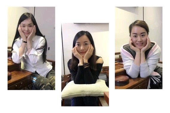 司徒莎莎种植发际线第391天美丽日记