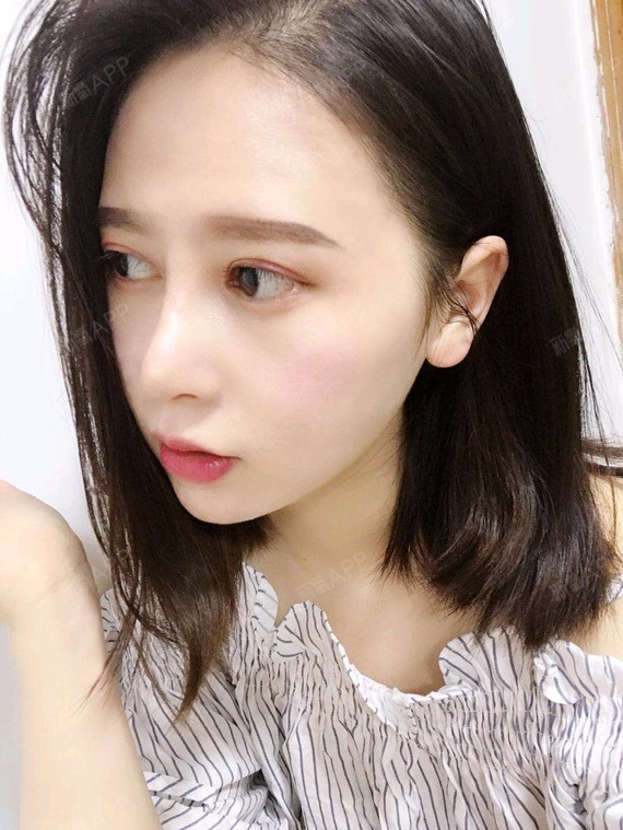 耳软骨复合隆鼻