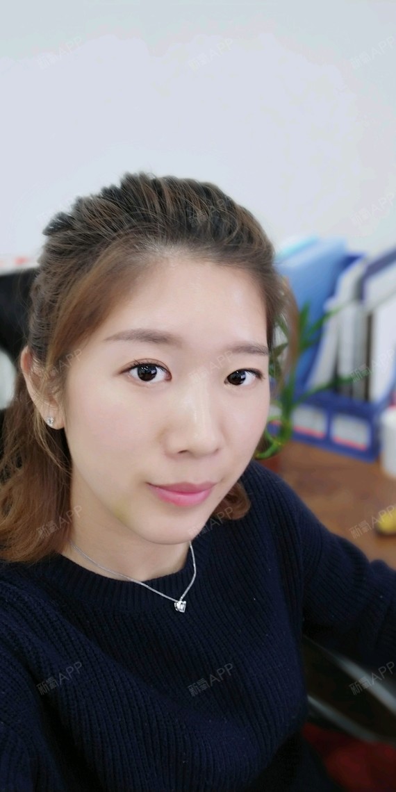 韩式生科下巴第20天