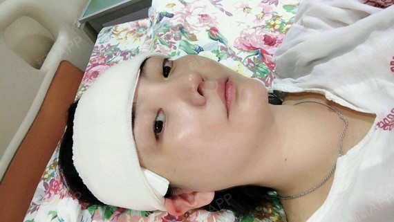 术后第一天刚做完头就被包扎了就像电视里放的坐月子一样