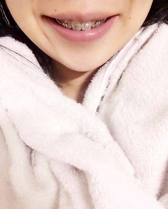 羡慕牙齿大颗的人,小颗的不好看