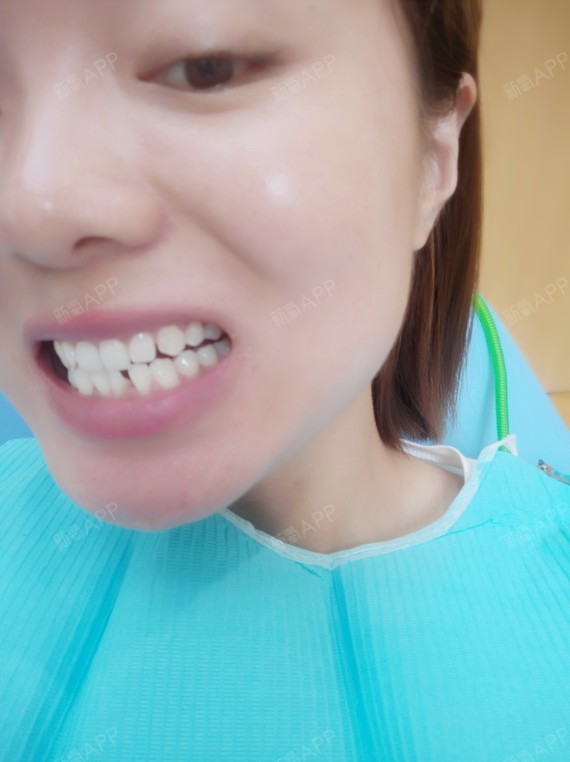 7号去希望能把牙齿给我装上,又不希望