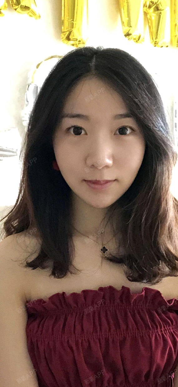 新氧- 氧气3706331514262184 | 面部轮廓 | 下巴 | 硅胶垫下巴 | 微