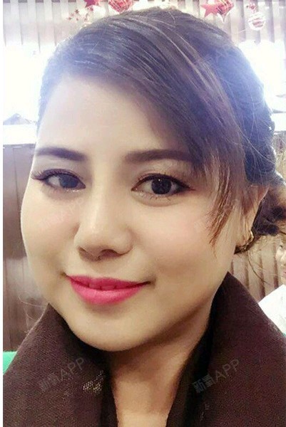 鼻子真的对一个人气质影响很大,曾经我是典型的广东人_圈子-新氧美容