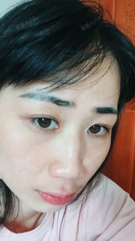 氧气bfy5402半永久纹眉第28天美丽日记