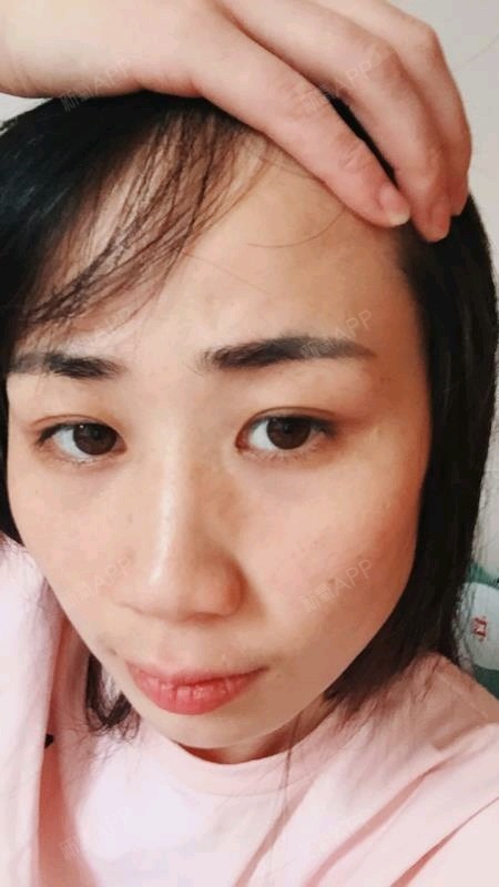 氧气bfy5402半永久纹眉第28天美丽日记