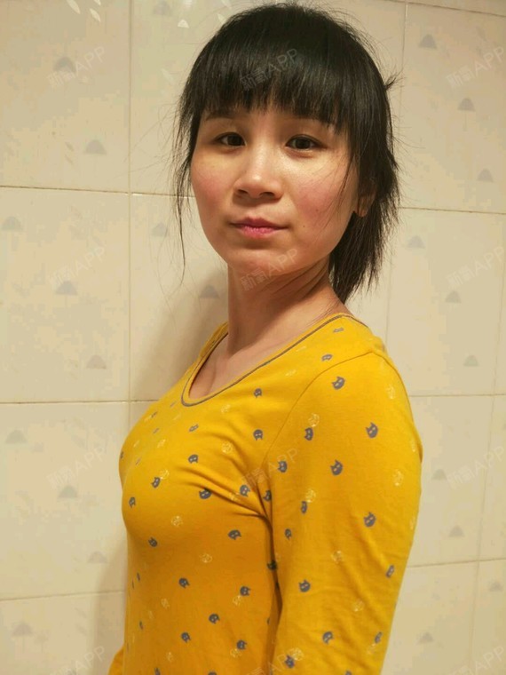 新氧- 见人 | 胸部 | 隆胸 | 假体隆胸 | 术后当自强 | 荆州同城