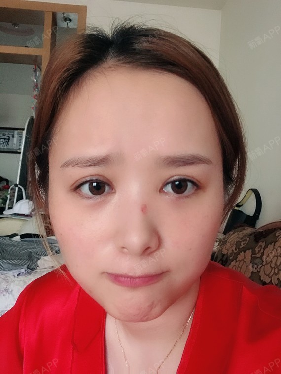 第10天